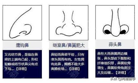 鼻相定富贵